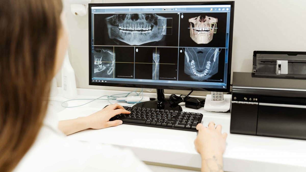 radiologie și tomografie dentară Ploiești