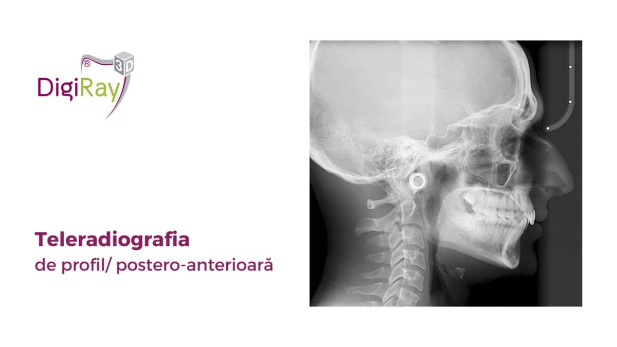 teleradiografia