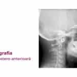 teleradiografia