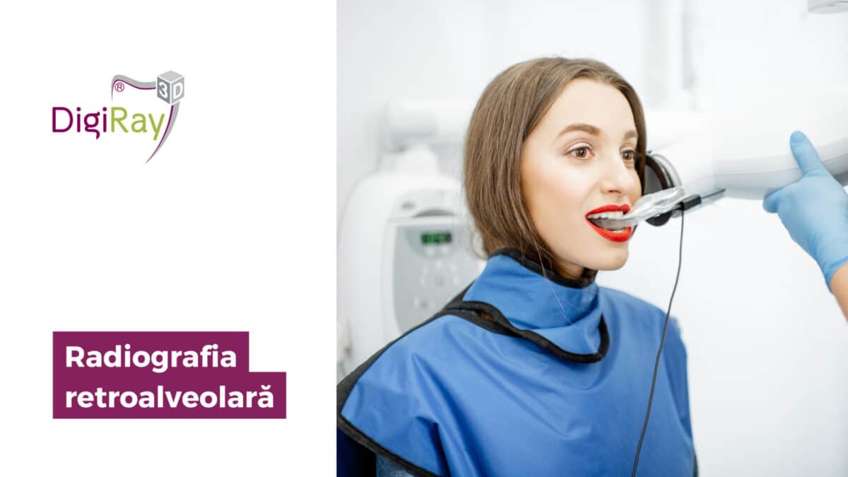 radiografia retroalveolară