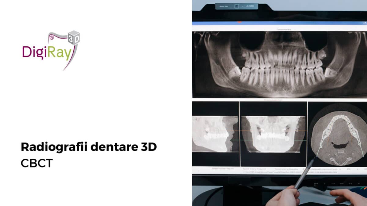 radiografii dentare 3D