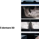 radiografii dentare 3D