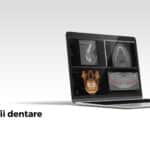 radiografii dentare