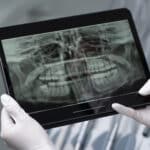 radiografie dentară