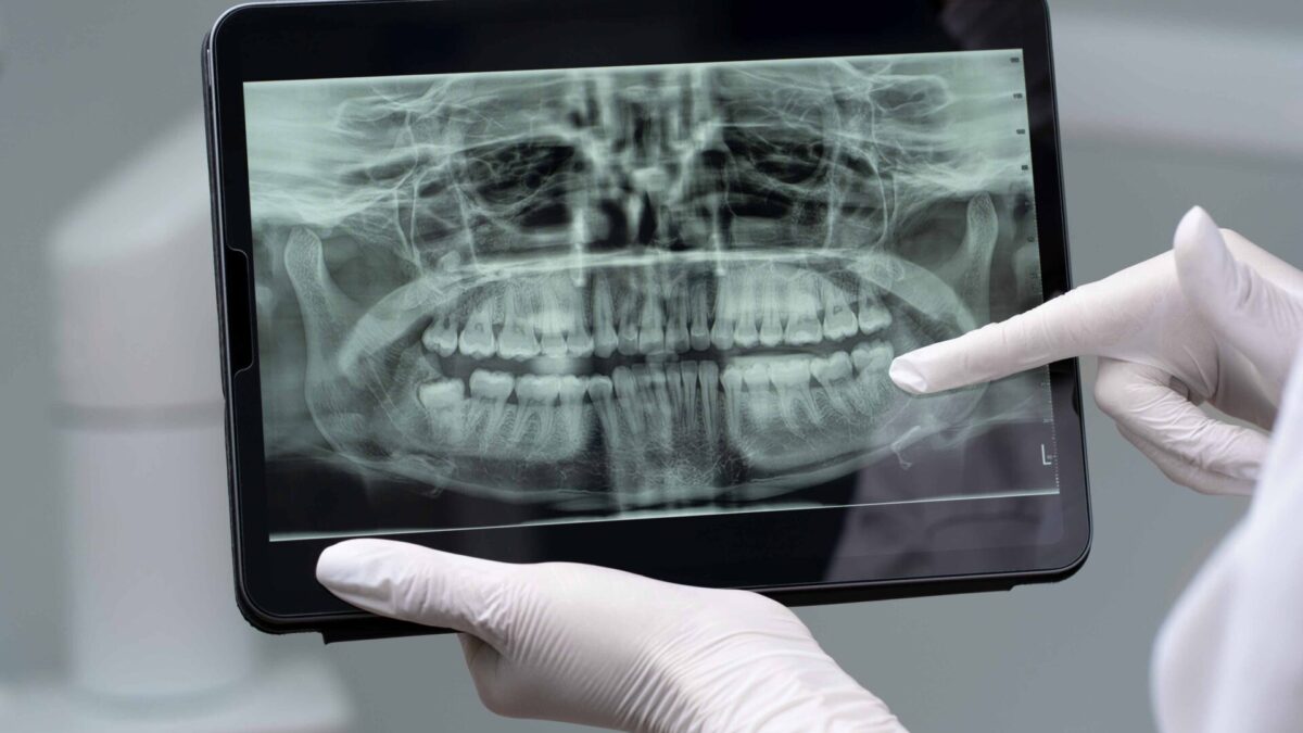 radiografii dentare