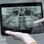 radiografii dentare