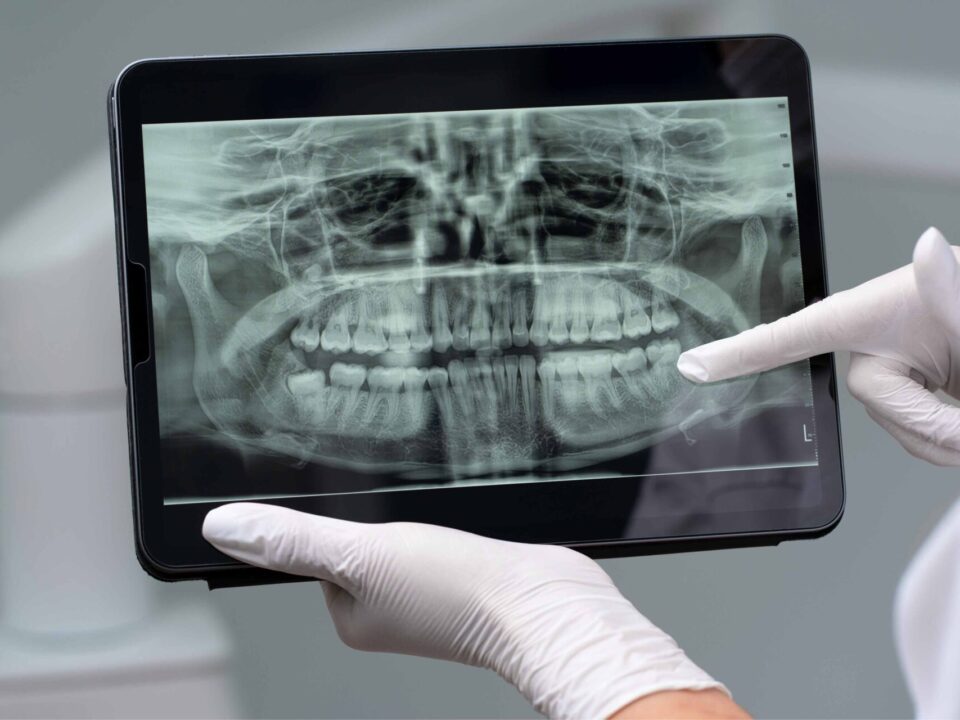 radiografii dentare